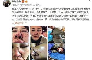 爆料博主毁容事件视频大全,博主视频大全背后的惊悚真相